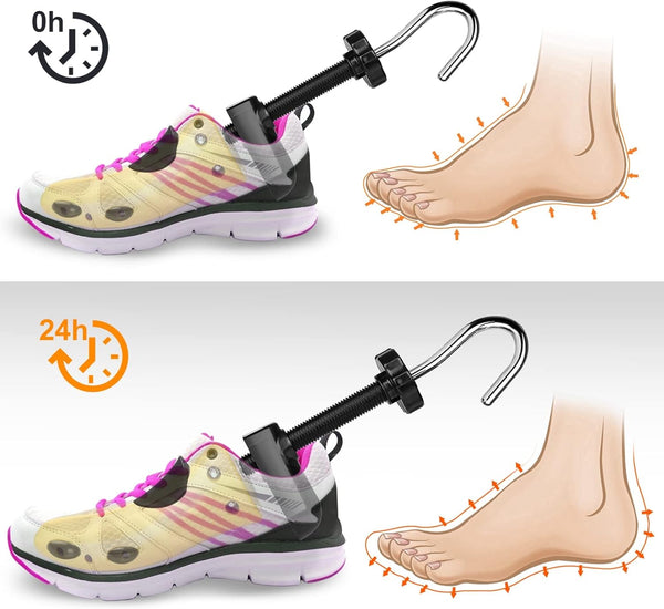 Smart Skoutvidgare Pro